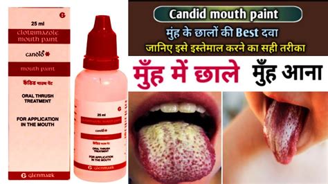 candid mouth paste|how to use candid mouth paint.